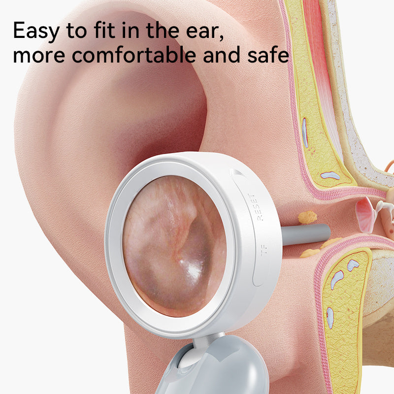 Smart Ear & Nose Camera with Screen - APS14