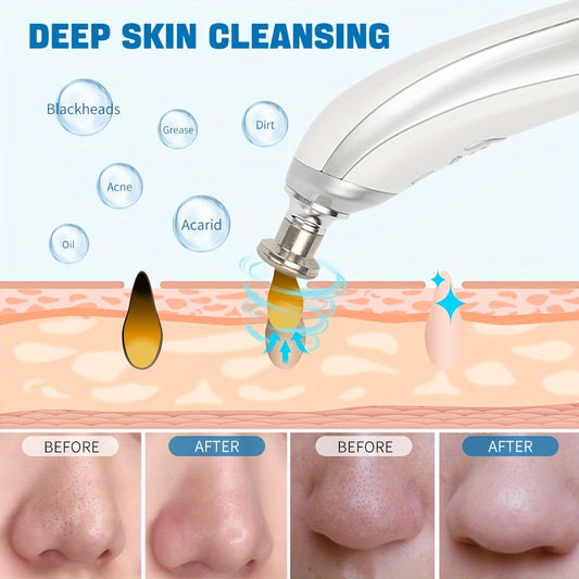 2in1 Pore Blackhead Remover- HMT16PR