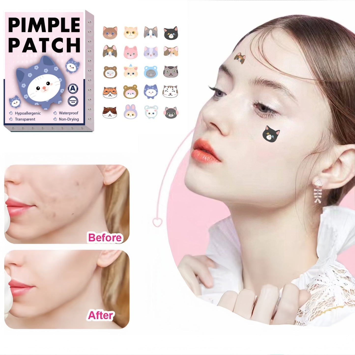 80pcs Cute Cartoon Cat Pimple Patches - HSC9