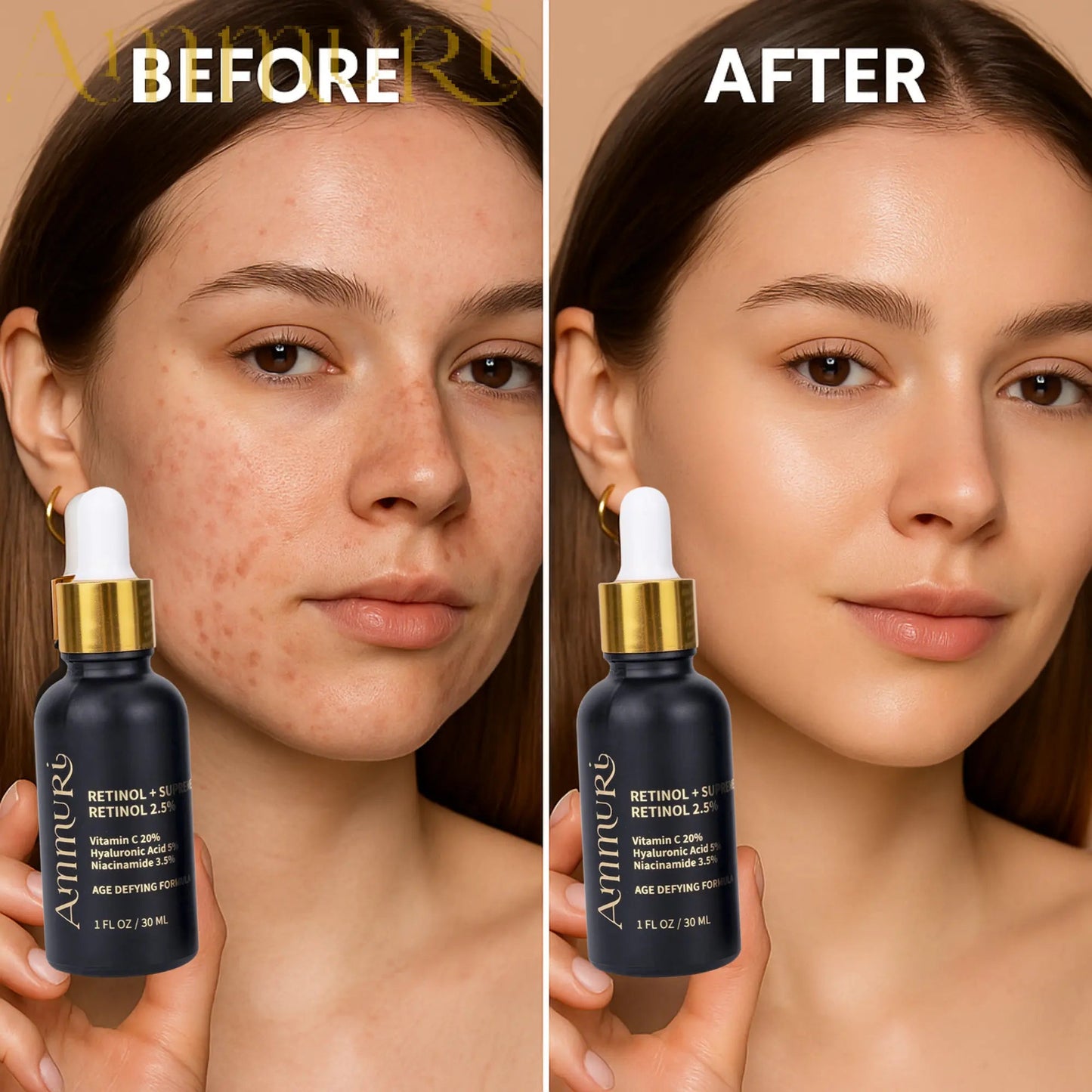 Ammuri Retinol 2.5% Supreme Serum – Gentle Anti-Ageing Treatment | 30ml