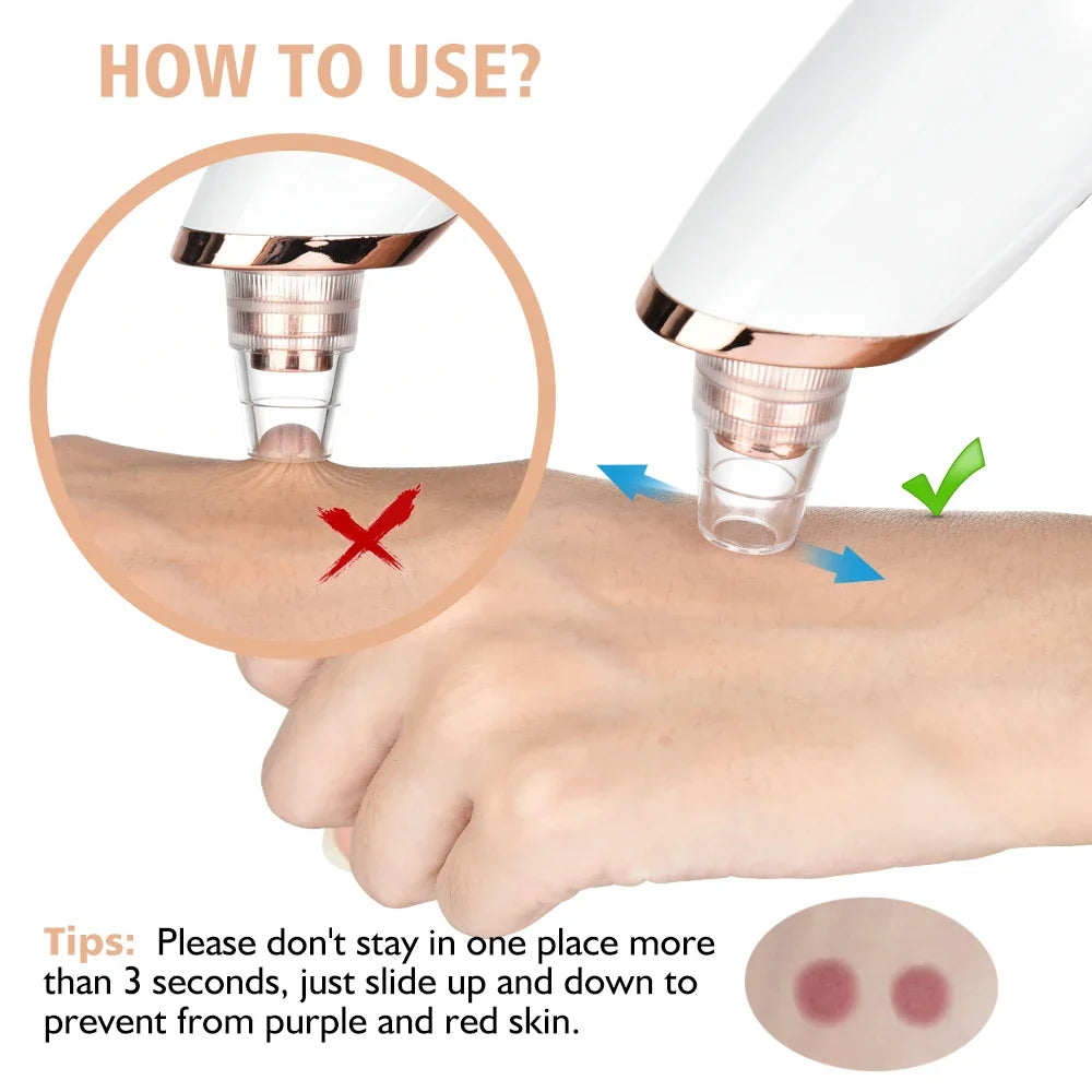 Blackhead Remover Vacuum – Electric Deep Pore Cleaner & Suction Tool for Facial Skincare