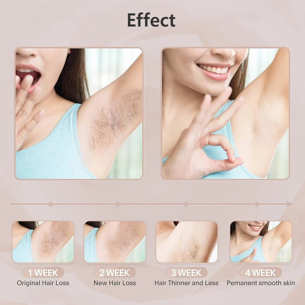 Hair Removal for Women – 999999 Flashes Painless Laser Epilator for Face, Body & Bikini Line