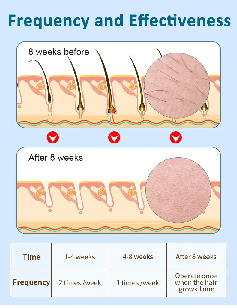 IPL Laser Hair Removal Machine Ice Cool Painless Epilator Women Freezing Point Epilation Skin Rejuvenation for Home Use Device
