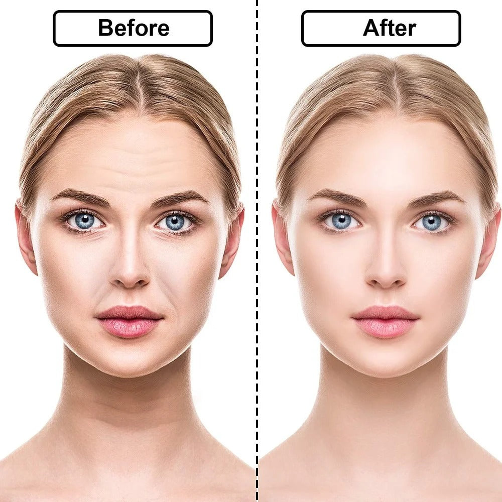 Reusable Silicone Wrinkle Removal Sticker Anti Wrinkle Pads Anti Aging Skin Face Lifting Patches Face Forehead Neck Eye Stickers