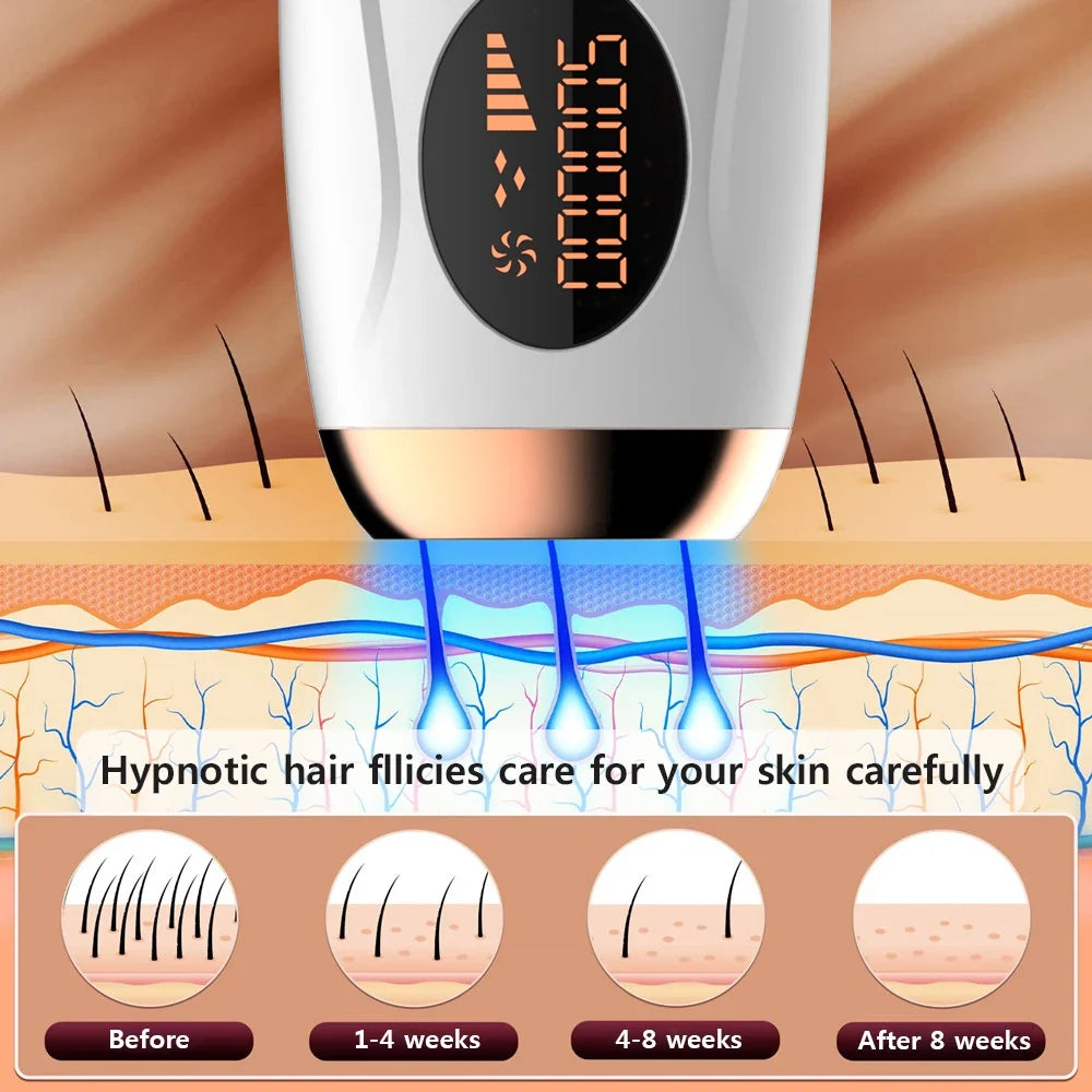 Hair Removal for Women – 999999 Flashes Painless Laser Epilator for Face, Body & Bikini Line