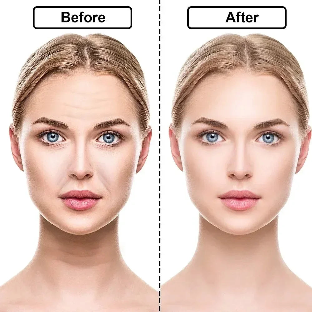 Reusable Silicone Wrinkle Removal Sticker Anti Wrinkle Pads Anti Aging Skin Face Lifting Patches Face Forehead Neck Eye Stickers