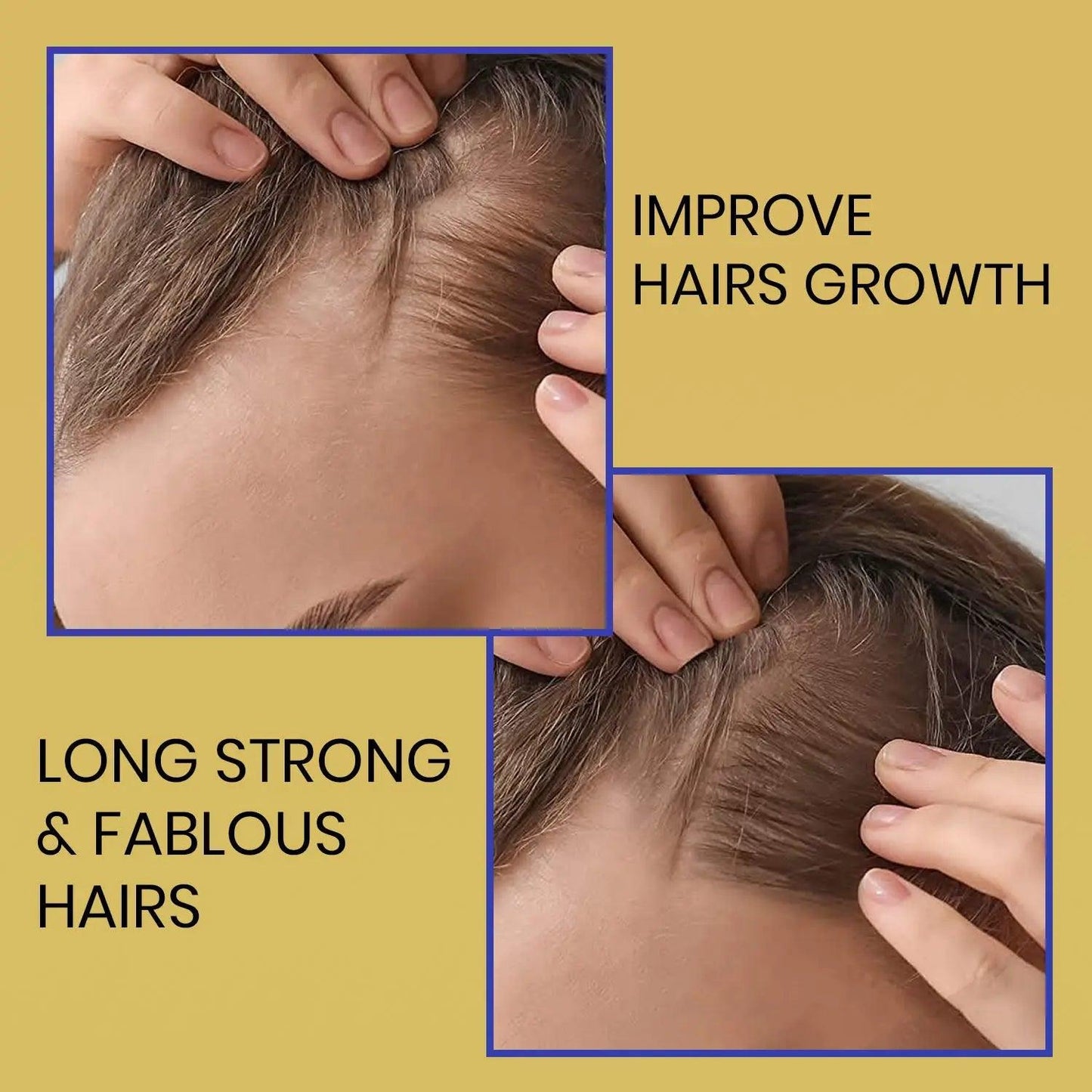 Ammuri Biotin Shampoo – DHT Blocker for Thicker Hair | Set of 2 x 473ml