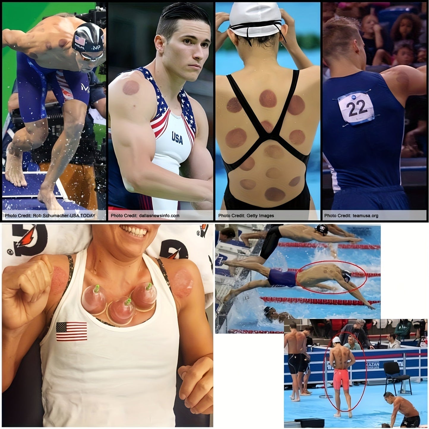 Premium Cupping Set Durable GiftReady-YH1U