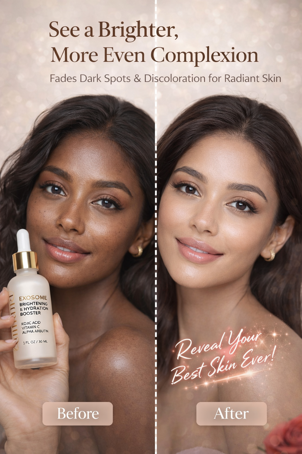 Exosome Brightening Serum for Dark Spots & Pigmentation | Ammuri